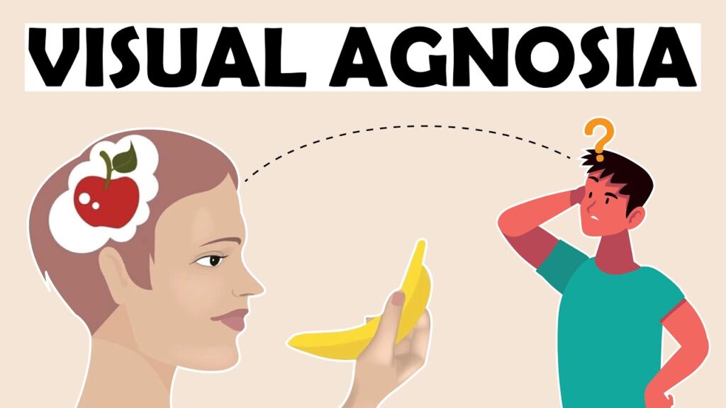 Hongye Furniture Group Co., Ltd | Why Dementia-Friendly Furniture Design Really Matters? Hongye Furniture Group Co., Ltd | Why Dementia-Friendly Furniture Design Really Matters?visual agnosia